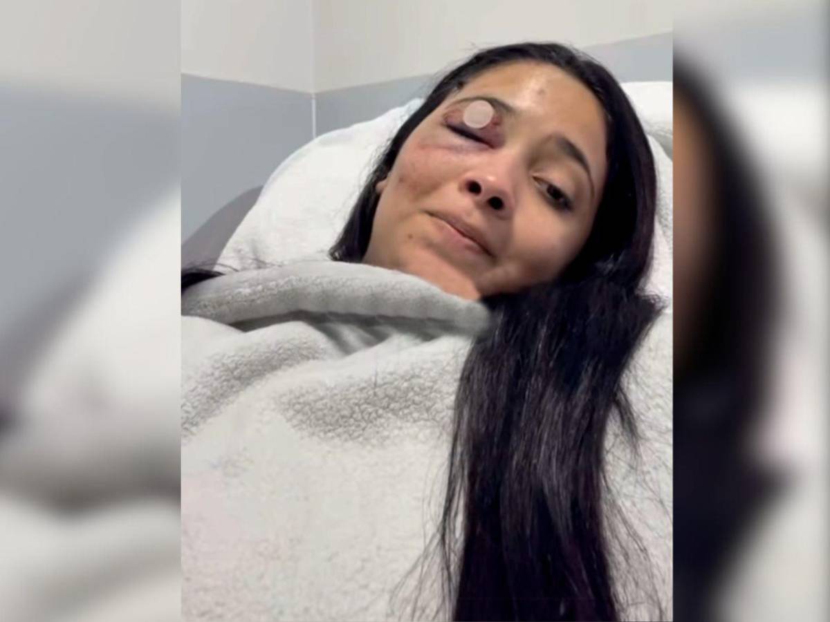 Entre lágrimas, sobreviviente de accidente en Roatán se pronuncia: Esto es bastante doloroso