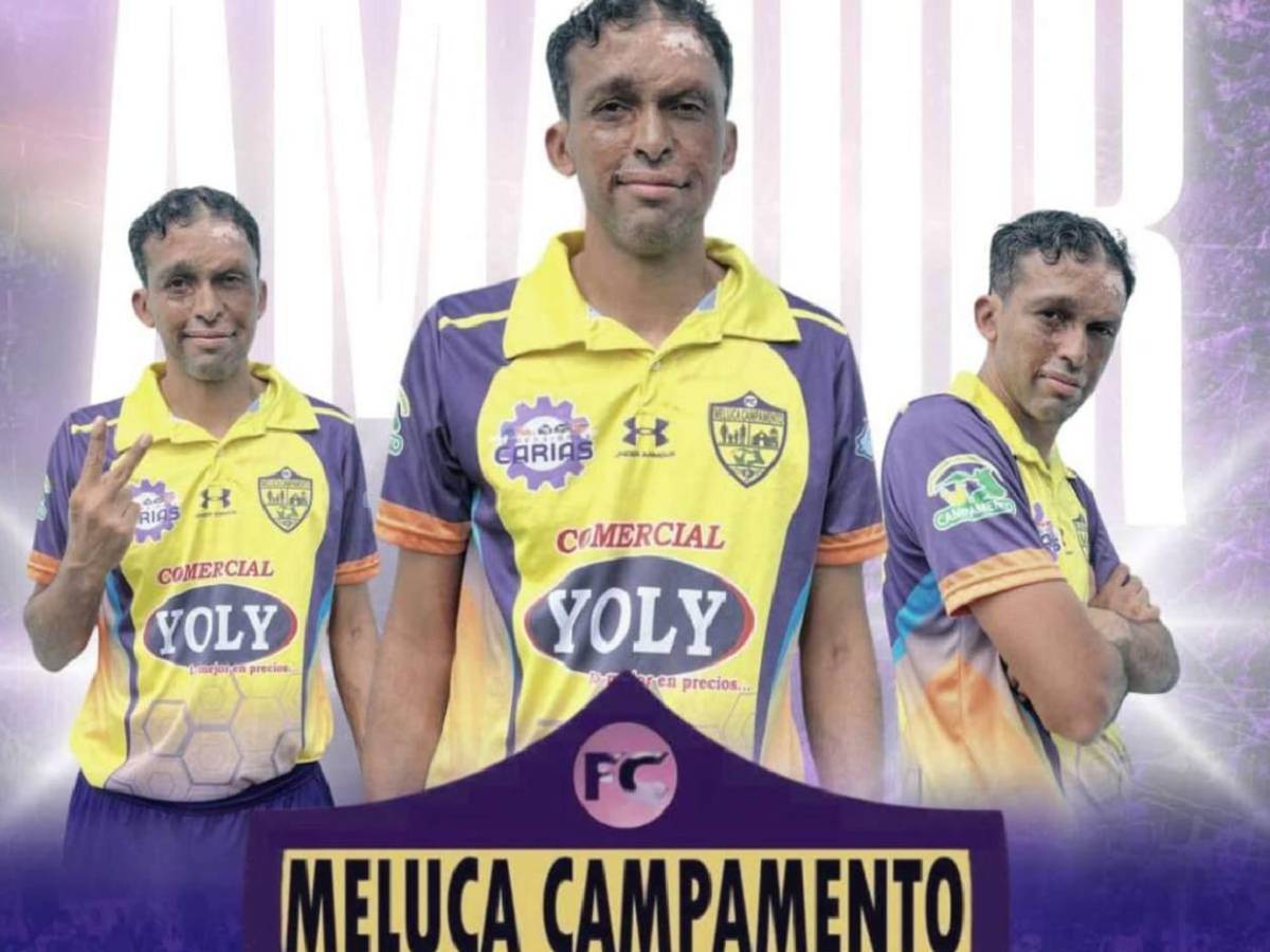 Político debutó en club de Honduras: ingresó al 90’ y esta fue su reacción