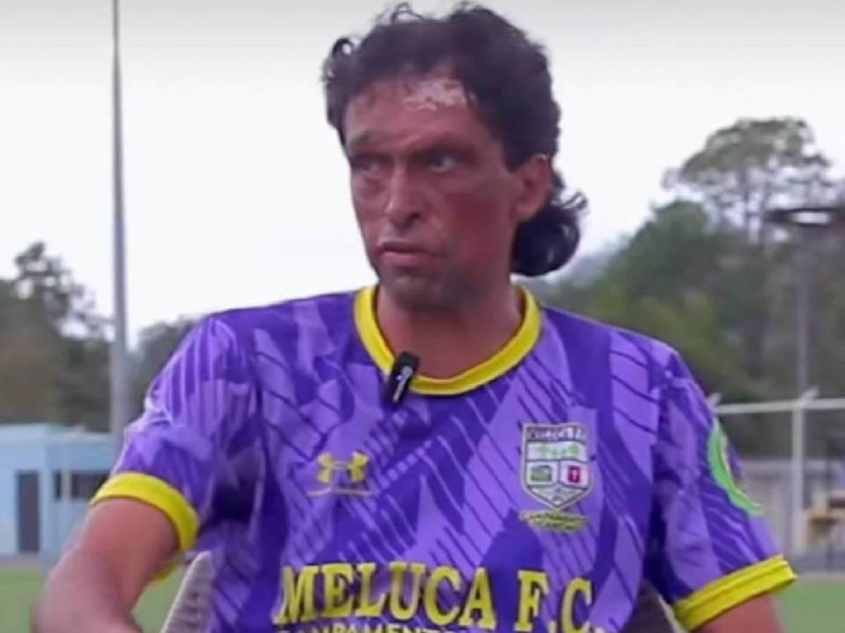 Revuelo: Pedro Joaquín Amador sorprende al debutar con club de Honduras