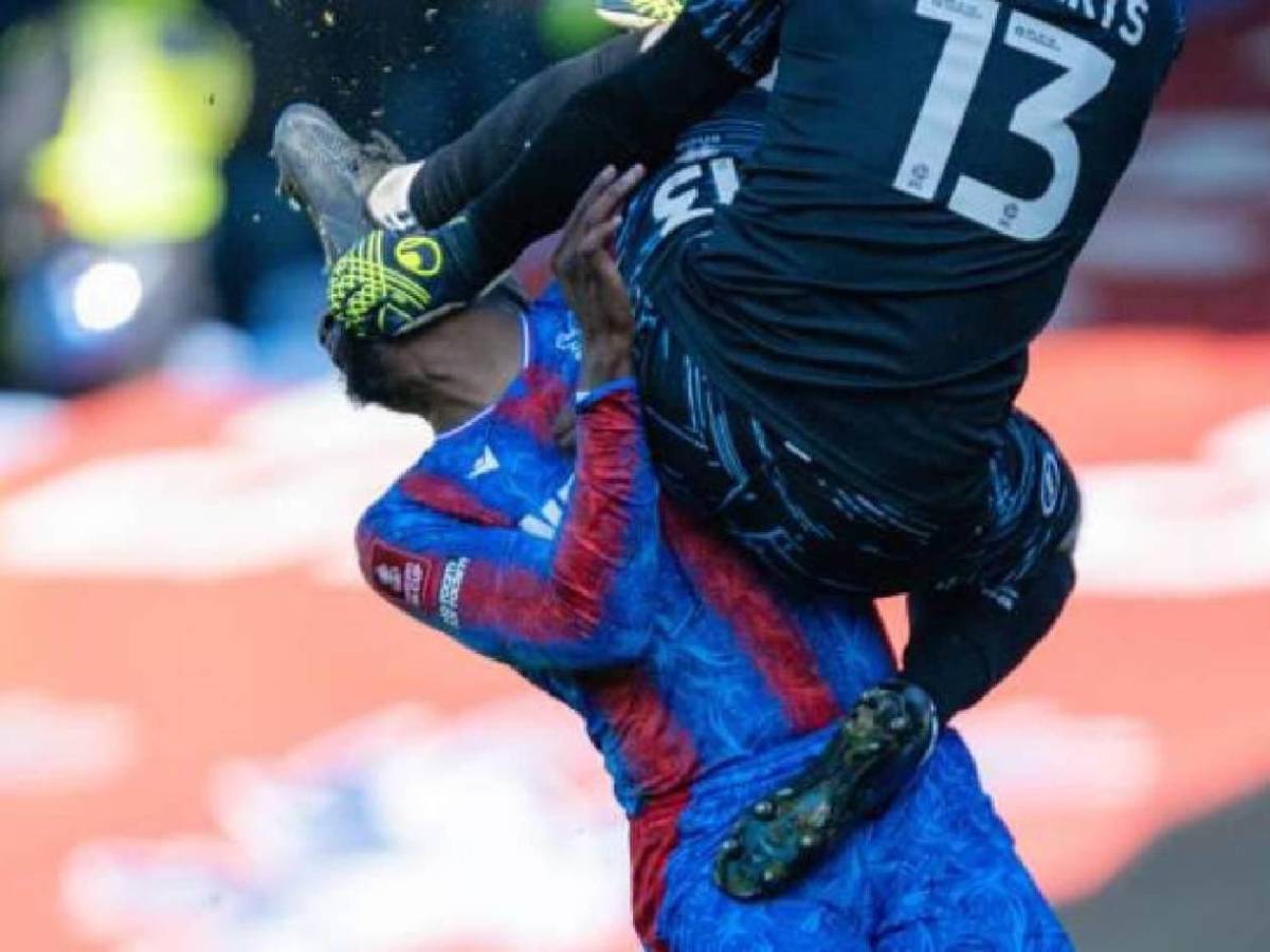 Sufrió una criminal patada en pleno partido y esto informan sobre su estado