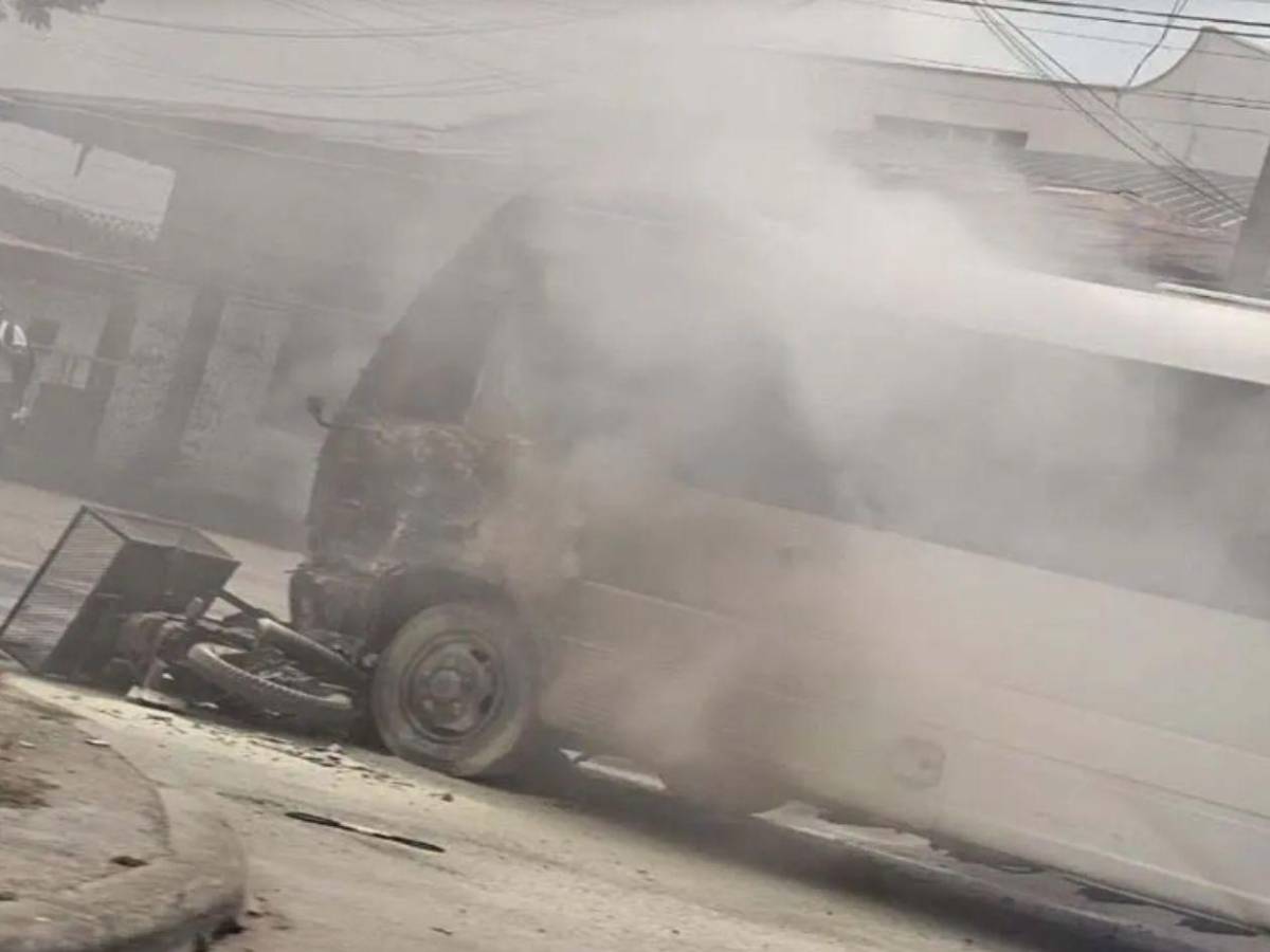 Revelan el estado clínico del hombre que sufrió quemaduras tras accidente en SPS