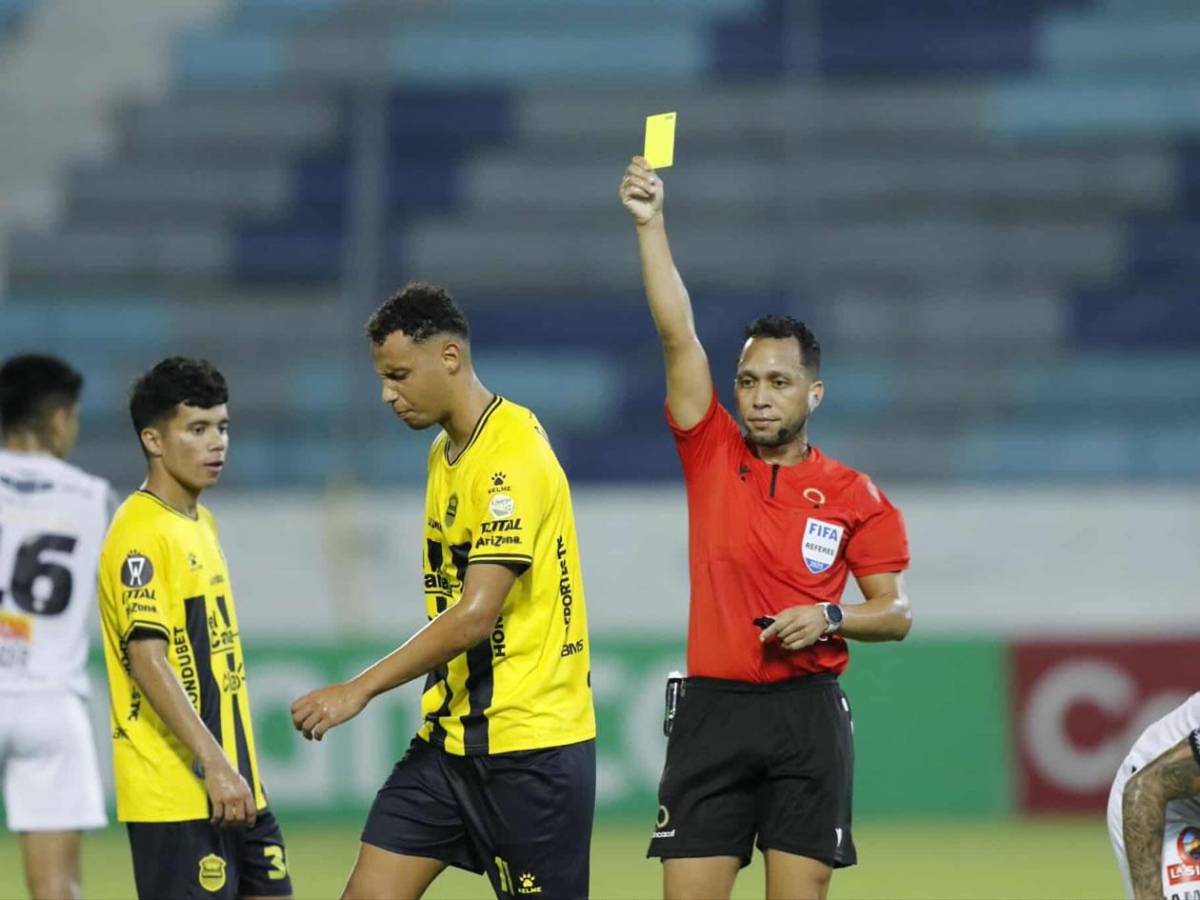 La alegría de Real España, grave lesión, jugador caminó descalzoy linda chica enamora