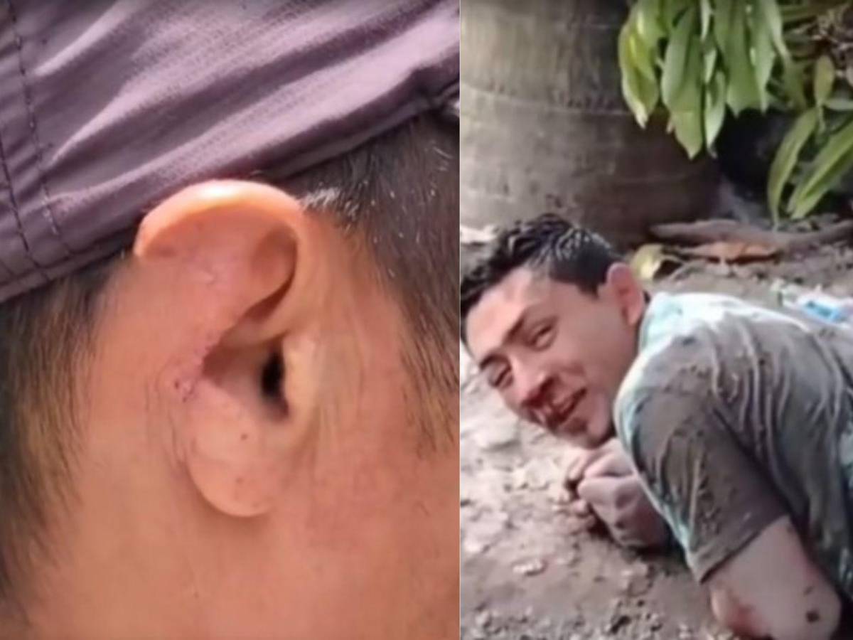 Un caníbal causa terror en Copán: ataca a mordidas y arranca orejas