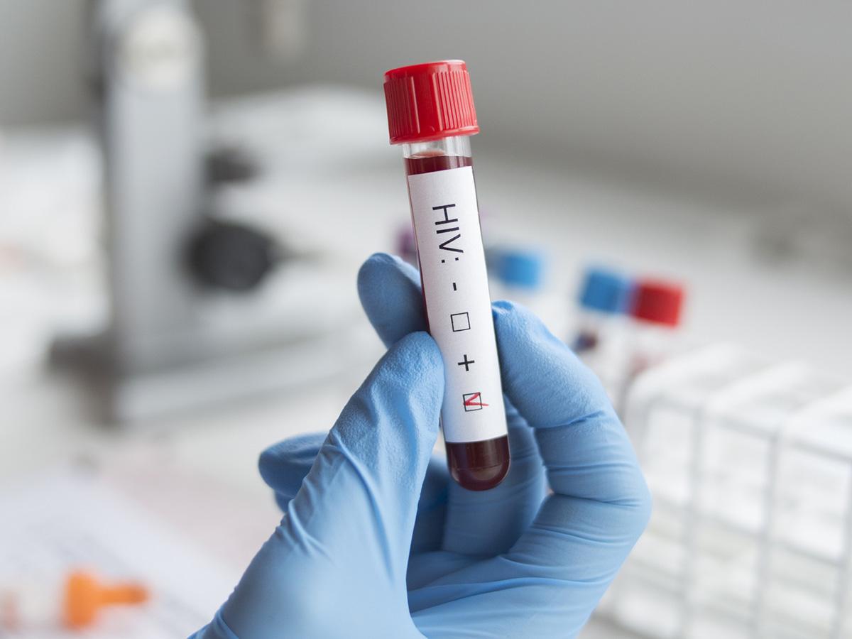 Honduras registró 1,099 casos de VIH