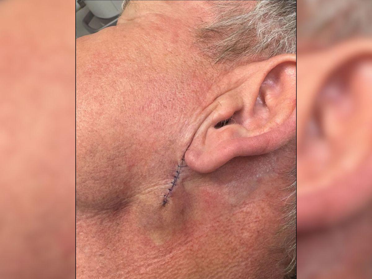 El chef Gordon Ramsay se somete a complicada cirugía tras ser diagnosticado con cáncer