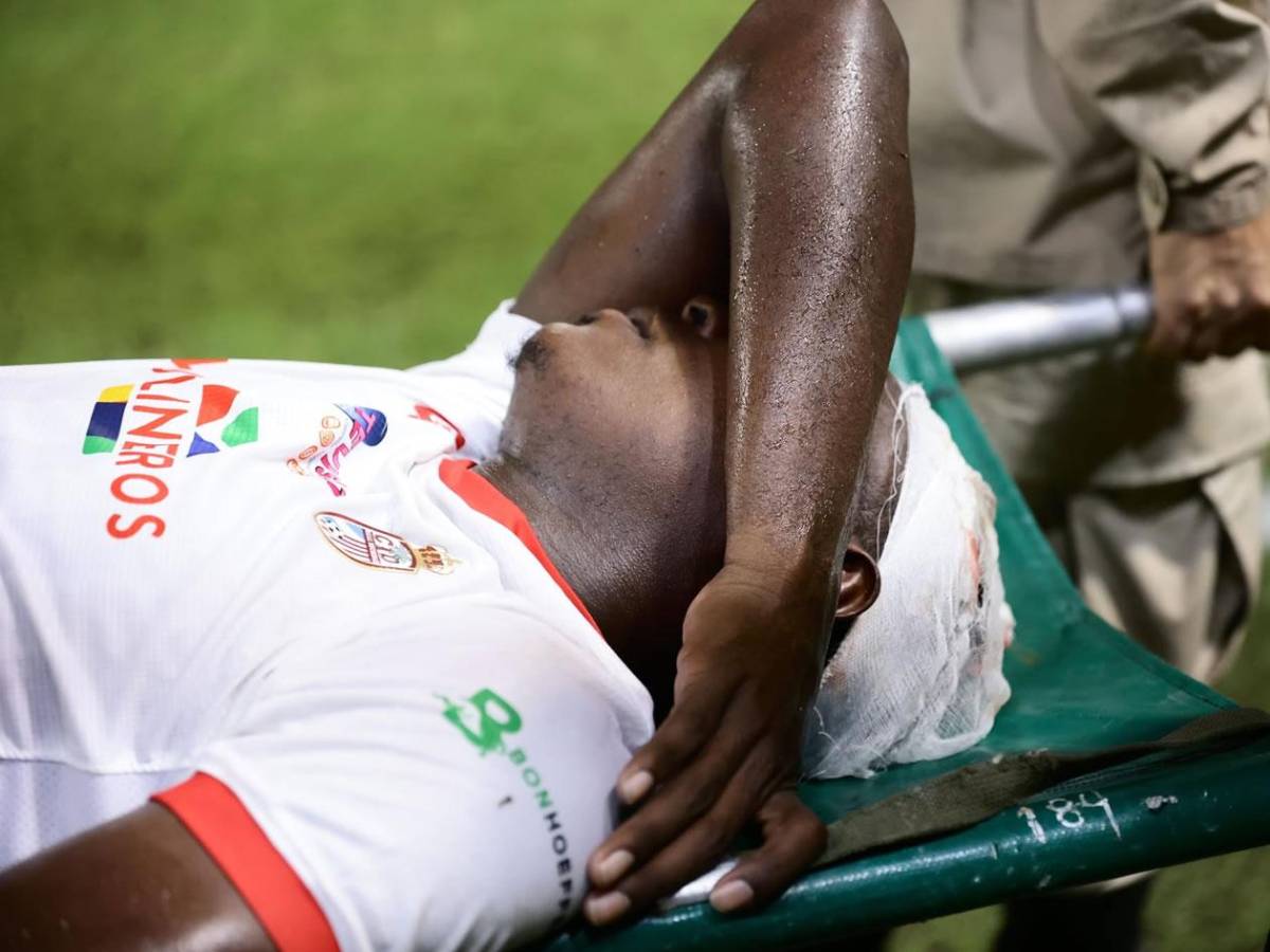 El Iron Man, jugador ensangrentado, frustración de Real España y bellezas