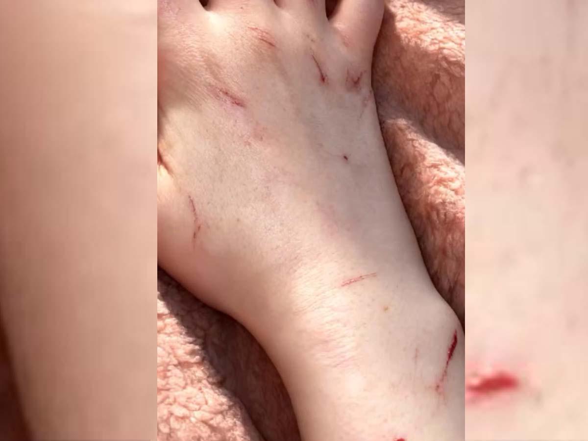 Joven usó inteligencia artificial para fingir su propio secuestro y terminó capturada