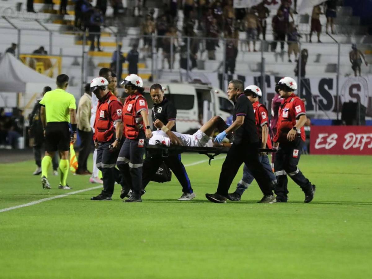 Olimpia da el golpe en Concacaf, dedicatoria, crack de Brasil y periodista roba miradas