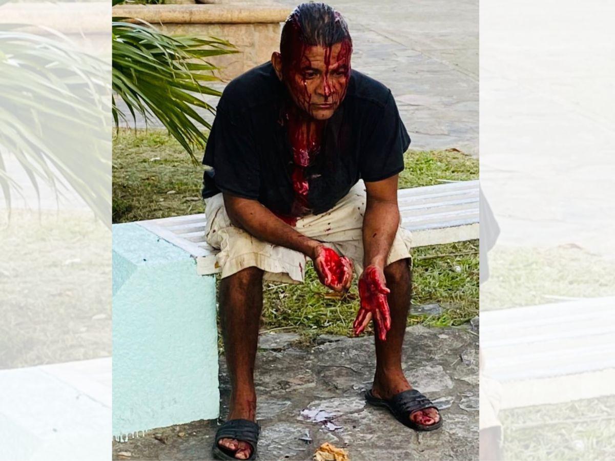 Todo se lo debo a él: Alexis Duarte reaparece en partido y su restauración es evidente