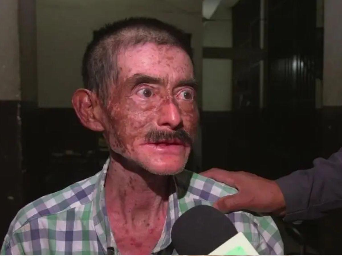 Llevaba un demonio: padre extrae a la fuerza el bebé de su hija embarazada