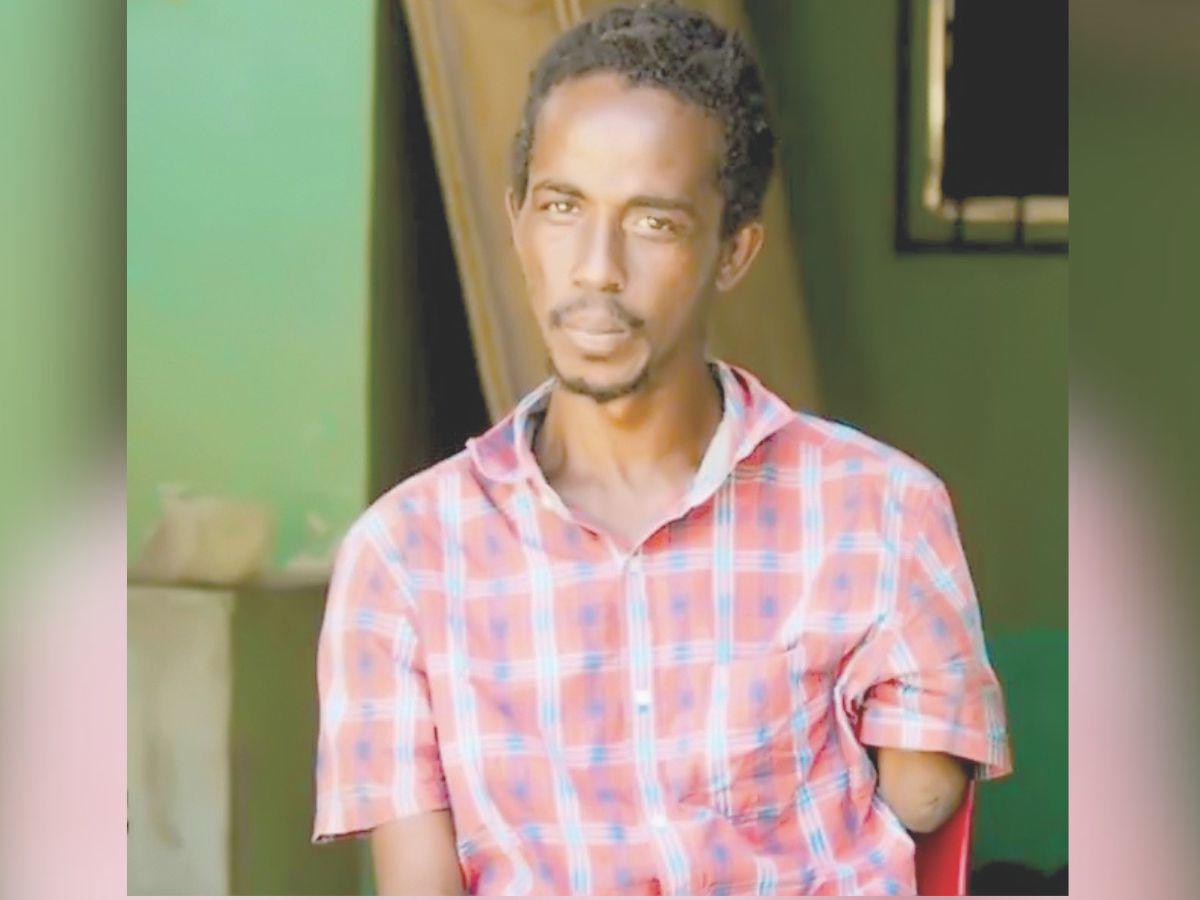 Muere al ser arrollado por ambulancia en La Lima