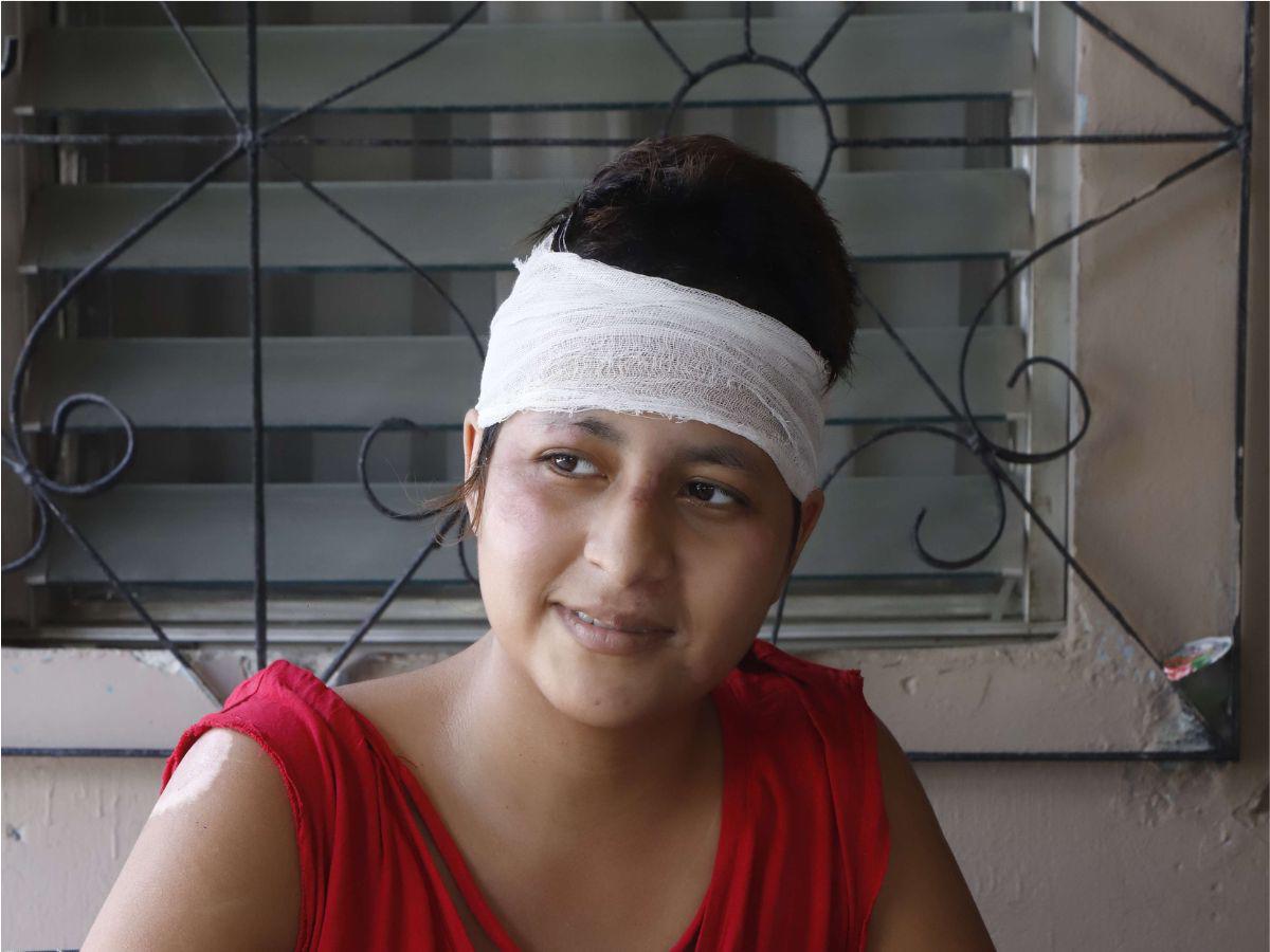 El calvario de Hazel: la sonrisa que no se borró a pesar de la tragedia