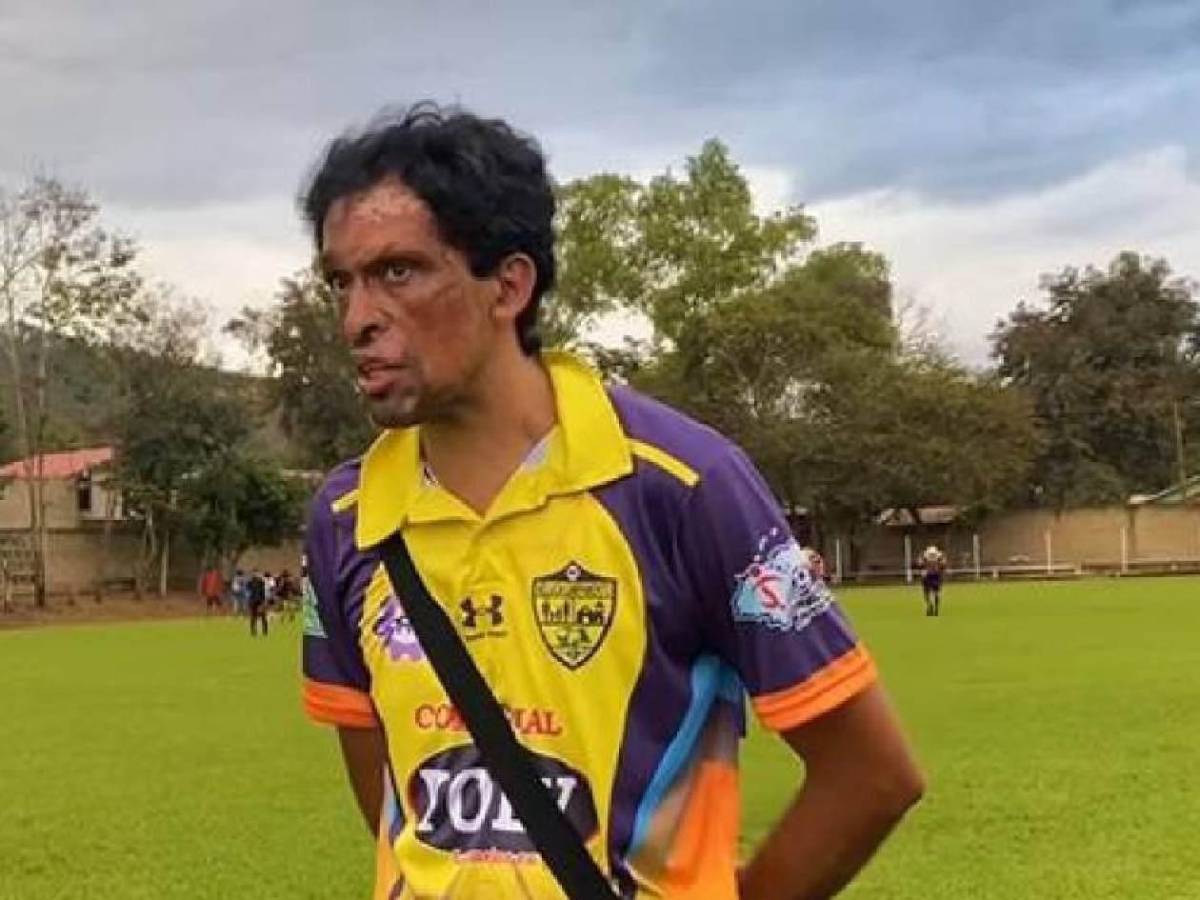 Político debutó en club de Honduras: ingresó al 90’ y esta fue su reacción