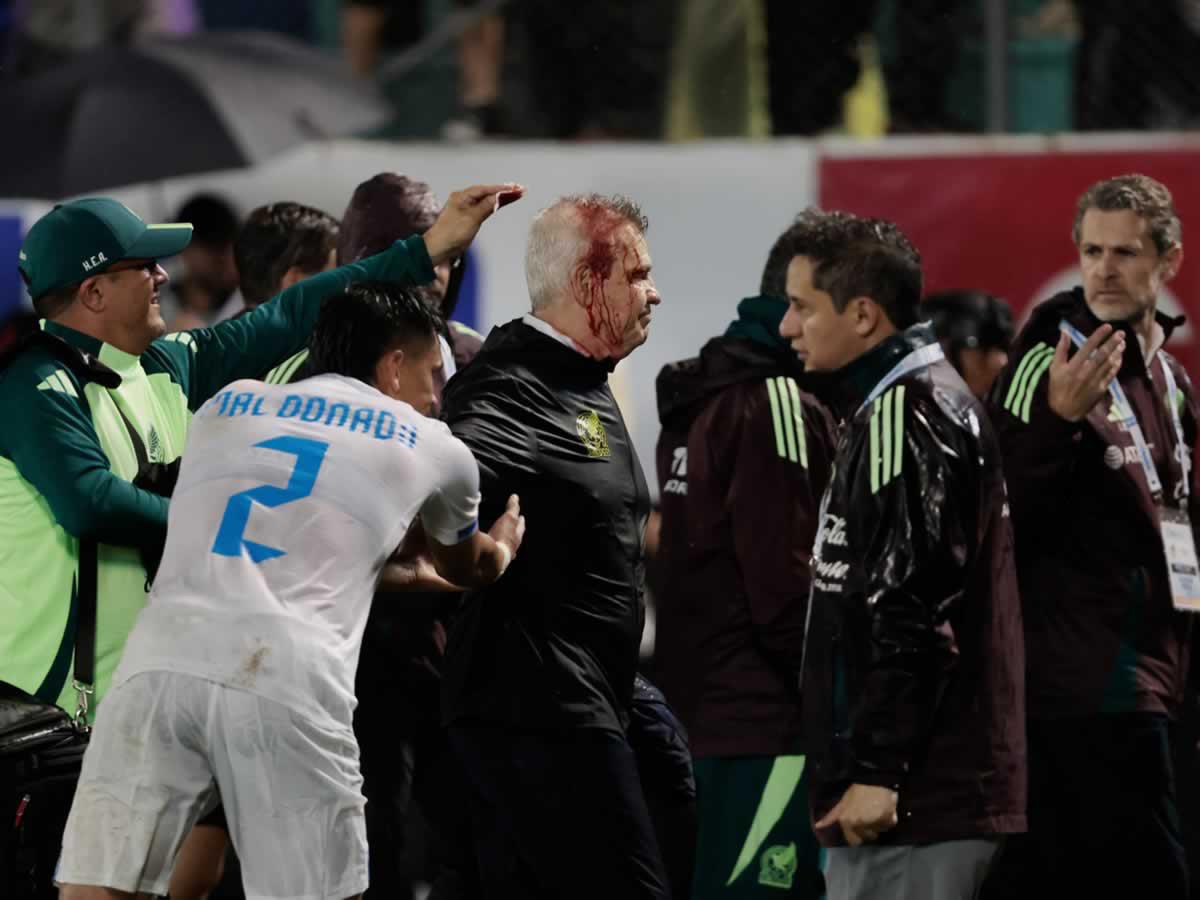 Javier ‘Vasco’ Aguirre se fue ensangrentado del campo del estadio Morazán tras la agresión.