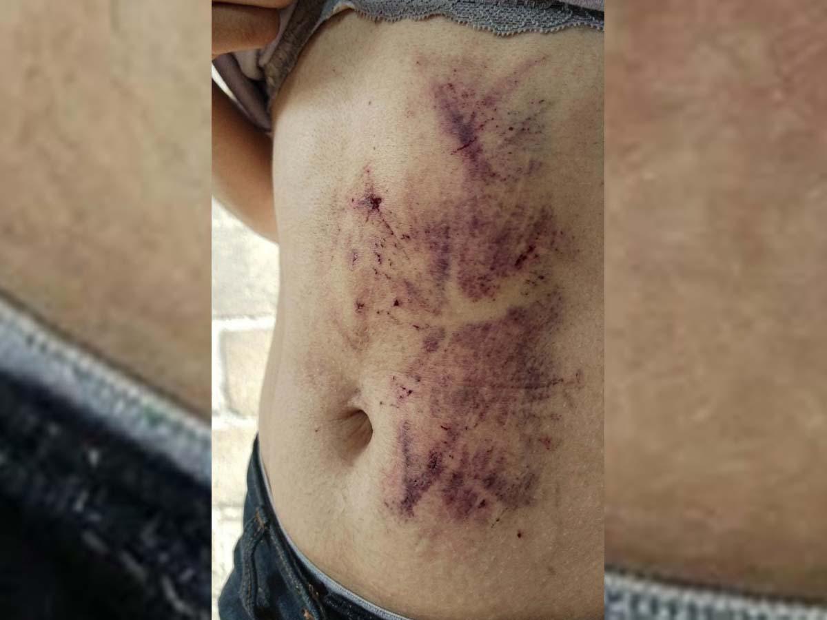 Joven usó inteligencia artificial para fingir su propio secuestro y terminó capturada