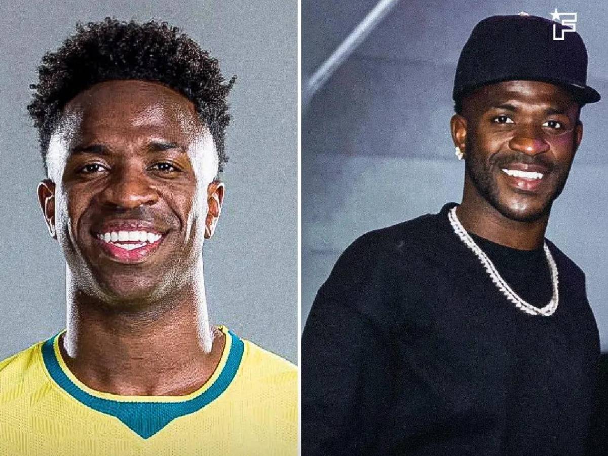 Vinicius con nuevo rostro: se operó y sorprende con brutal cambio tras el Mundial