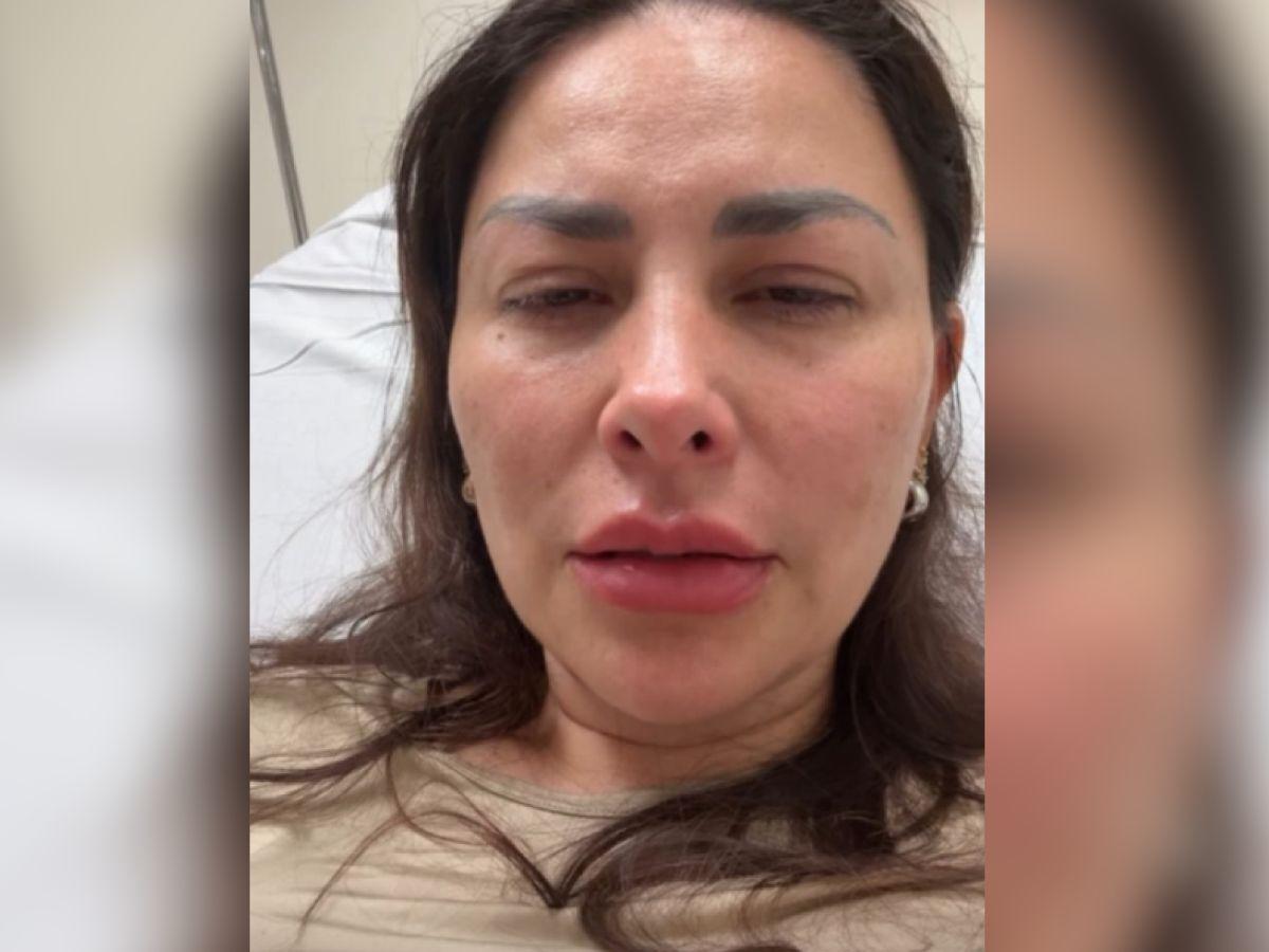 Querida actriz de Televisa sufre ataque de un pitbull: Puedo perder una extremidad