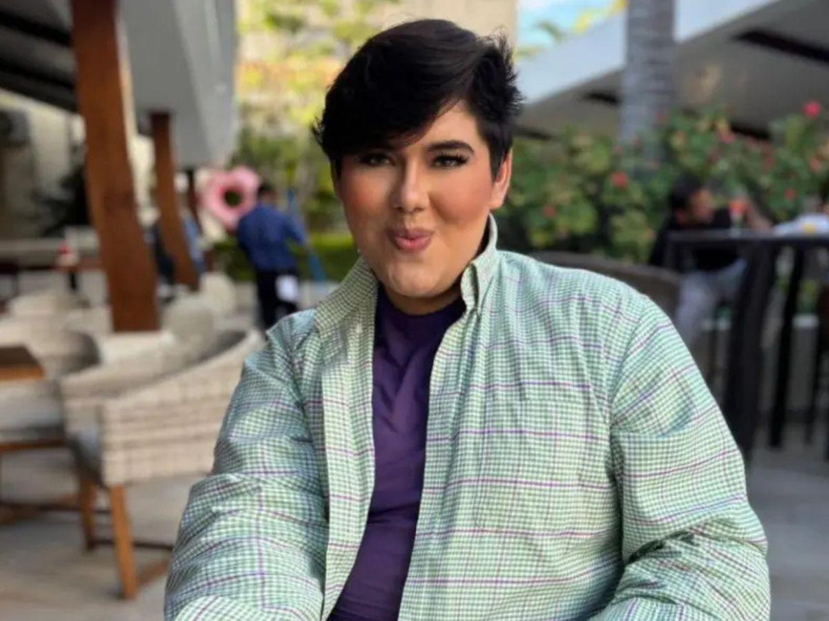 Antonio Sandrez presume sus nuevos labios: “Atáquense y admiren