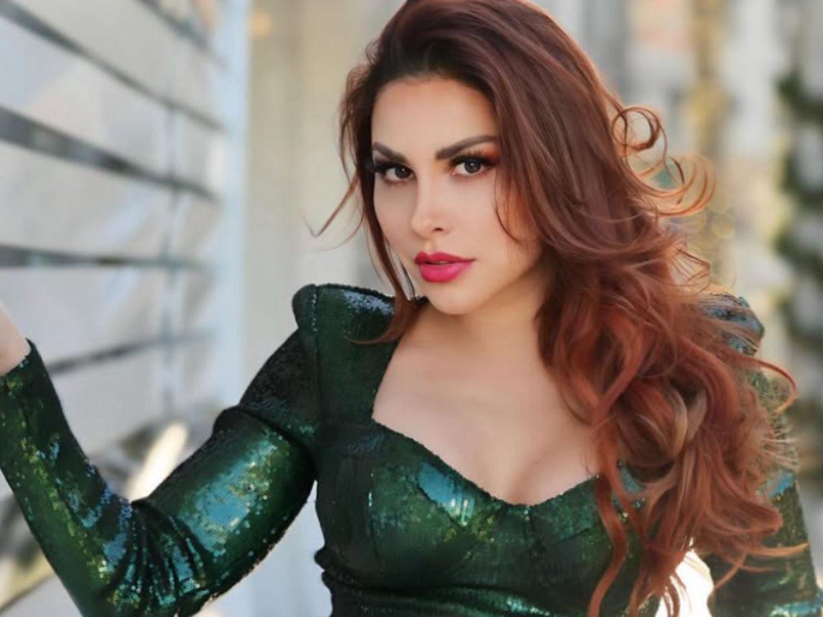 Querida actriz de Televisa sufre ataque de un pitbull: Puedo perder una extremidad