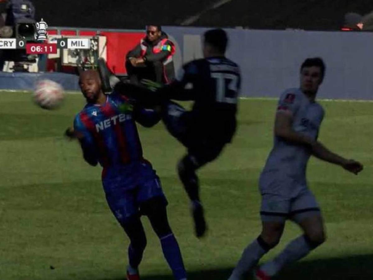 Sufrió una criminal patada en pleno partido y esto informan sobre su estado