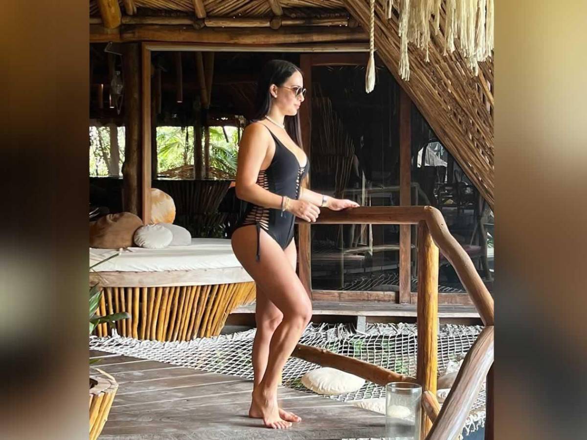 Se divorcia de uno de los ‘futbolistas más feos’ que se operó el rostro