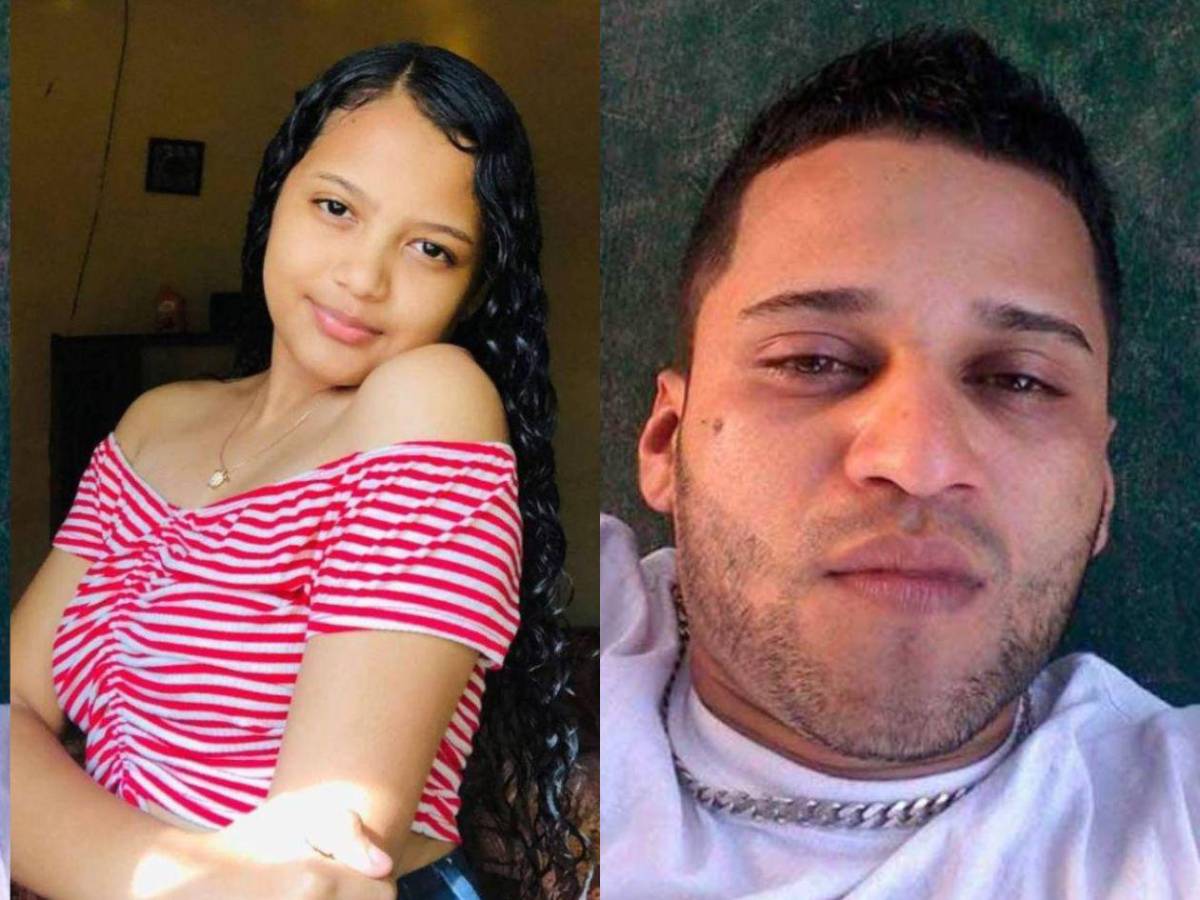 Como si fuera un pitbull: Hombre ataca a mordidas a su pareja en Olancho