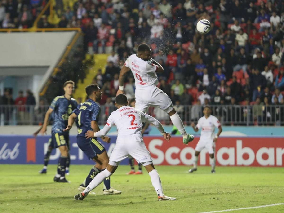 Olimpia se derrumba ante América, dedicatoria de Jorge Álvarez y novia de futbolista