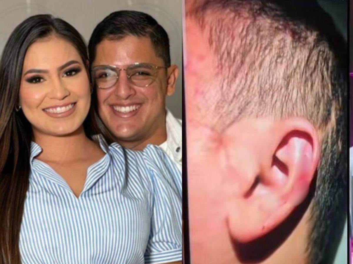 Alejandra Rubio filtra fotos de agresiones de Javian Thompson