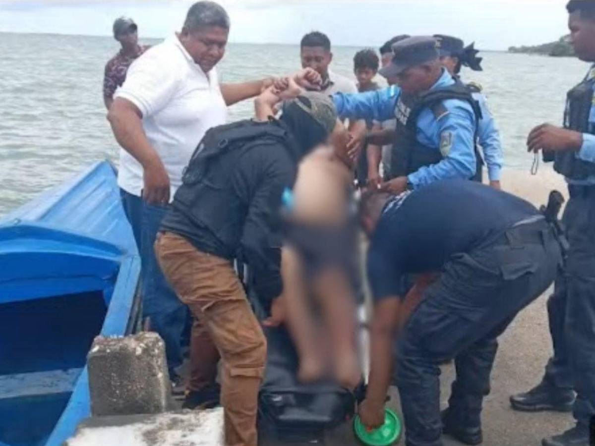 Acusado de matar a su esposa termina hospitalizado tras brutal agresión en Puerto Lempira