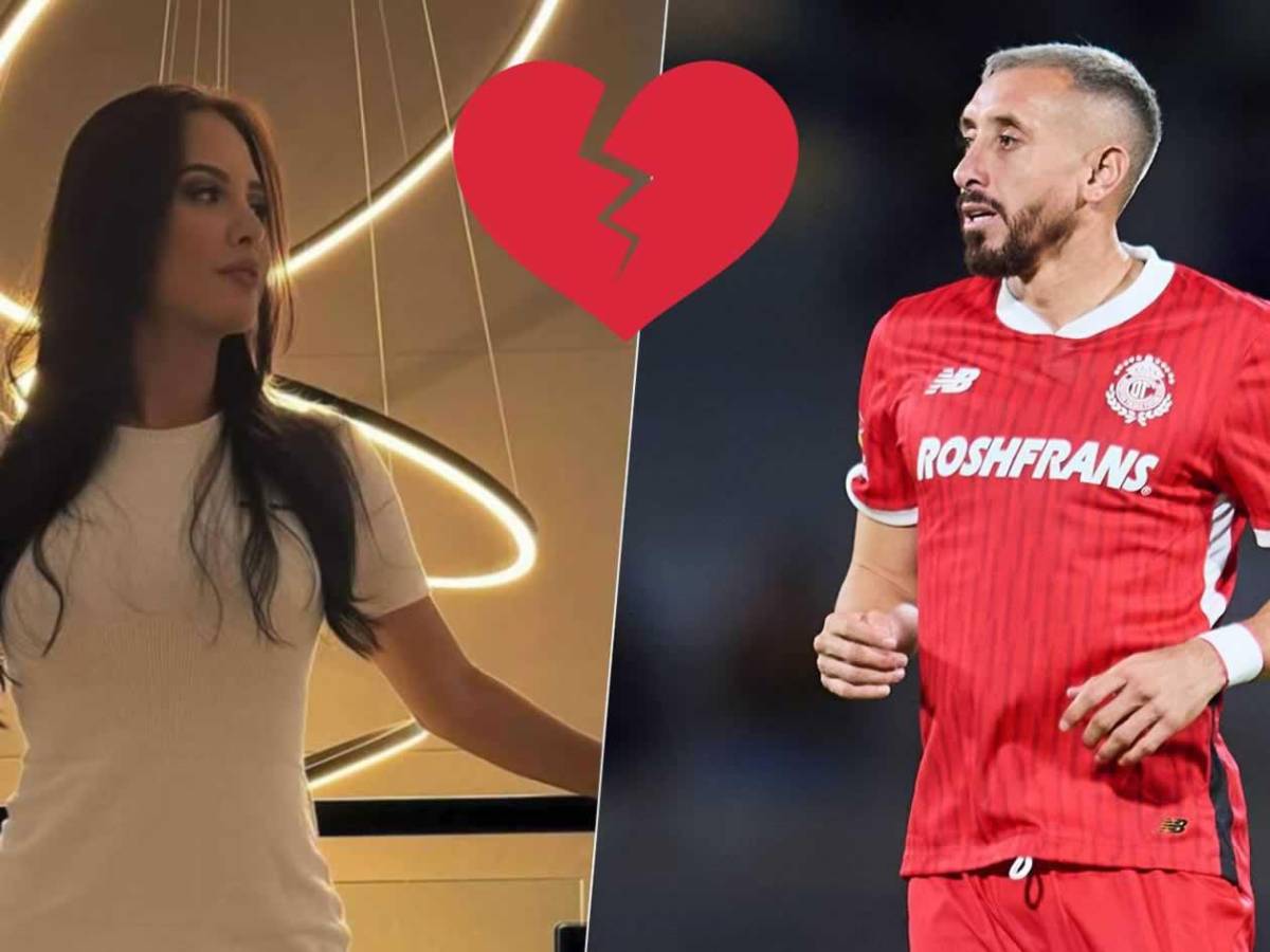 Se divorcia de uno de los ‘futbolistas más feos’ que se operó el rostro