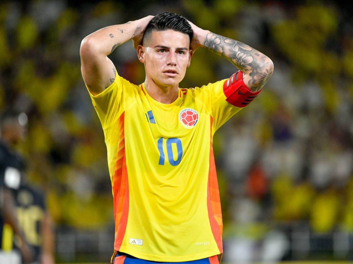 James Rodríguez en alerta: hospitalizado a dos meses del Mundial 2026
