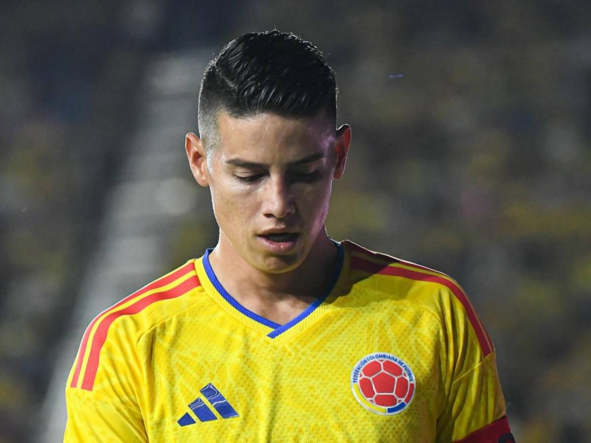 ¿James Rodríguez sufre de rabdomiólisis mortal? Surge noticia sobre el colombiano