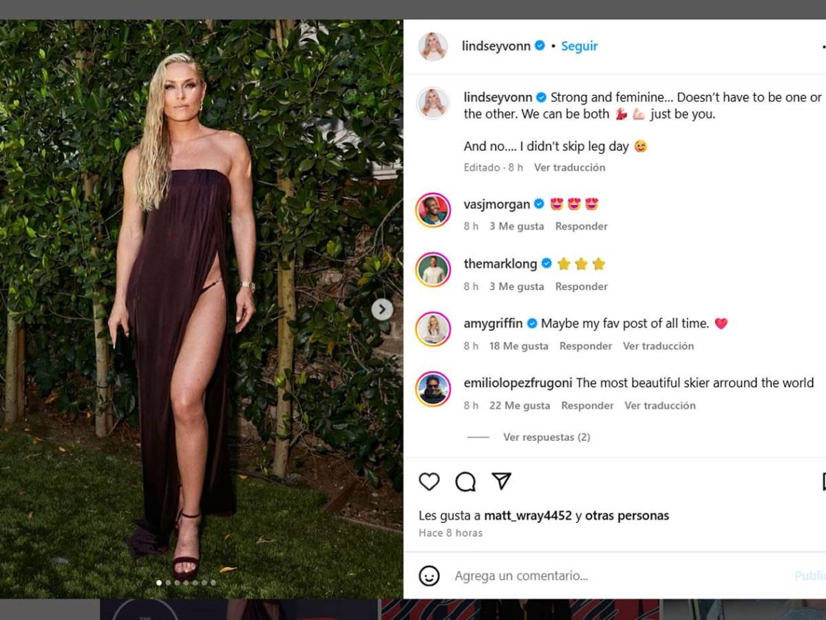 El incómodo descuido que sufrió famosa deportista en alfombra roja de los premios ESPYS