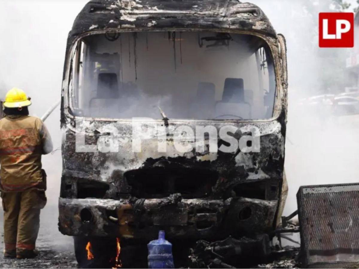 Revelan el estado clínico del hombre que sufrió quemaduras tras accidente en SPS