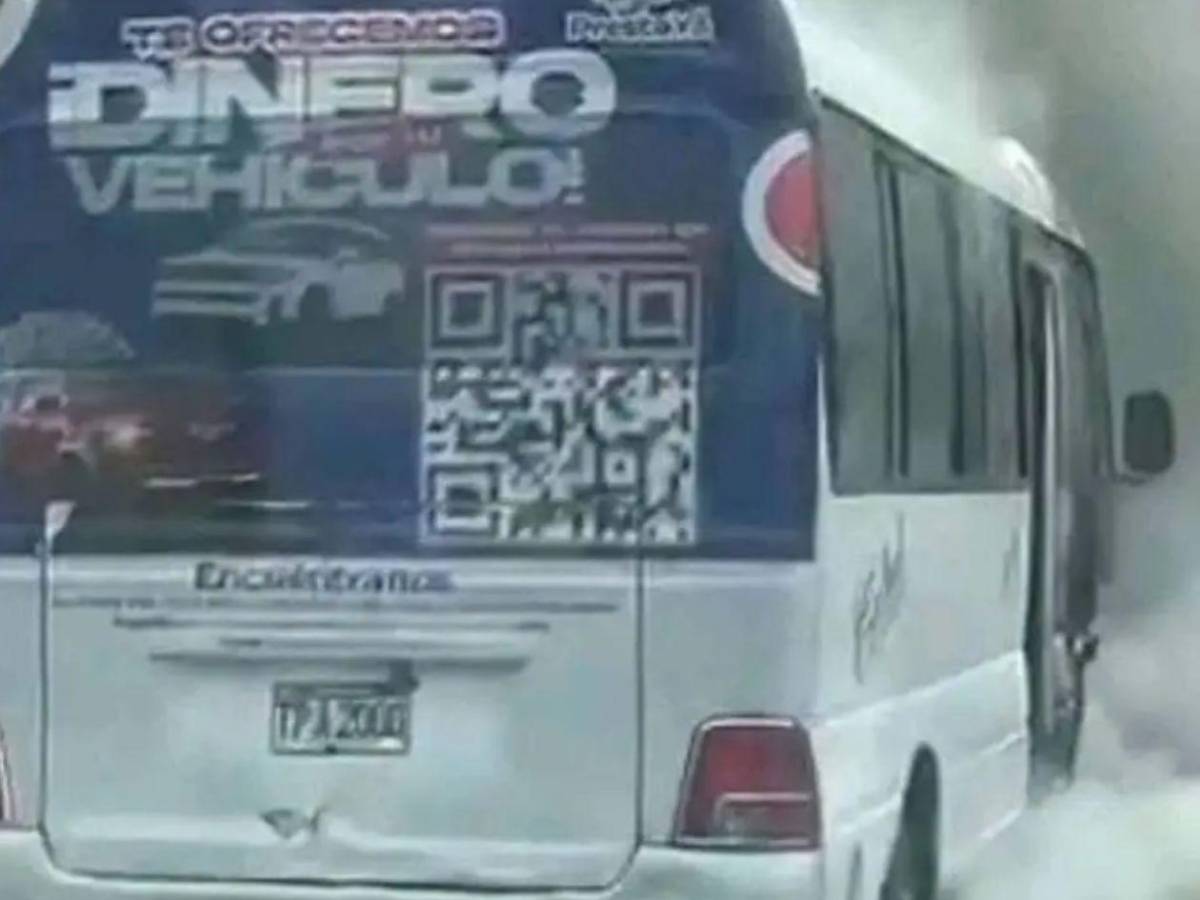 Revelan el estado clínico del hombre que sufrió quemaduras tras accidente en SPS