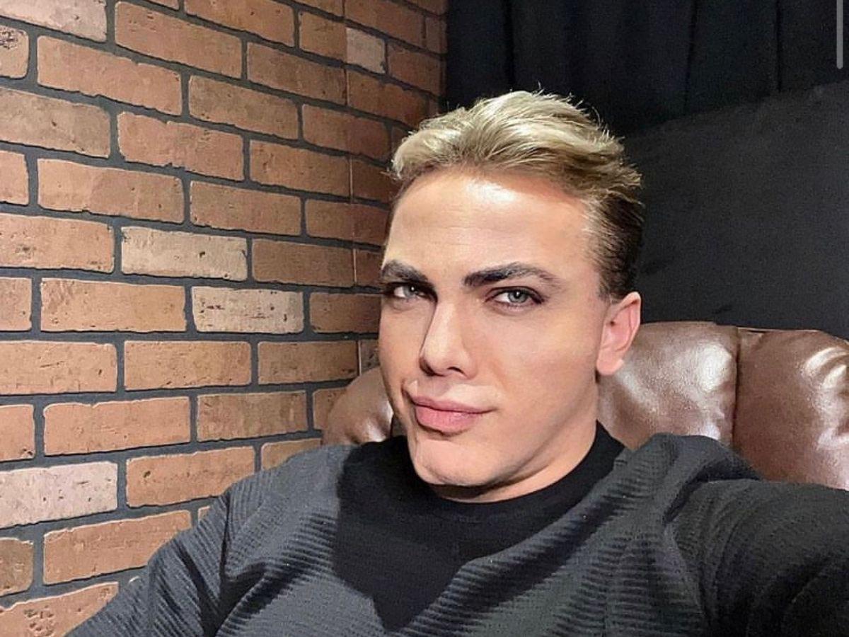 Cristian Castro luce irreconocible con su nuevo rostro