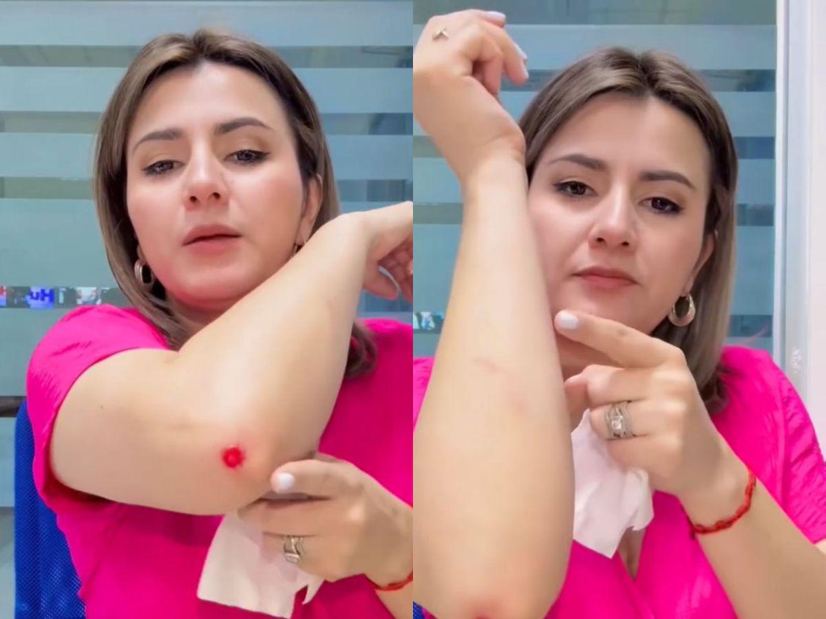 Cesia Mejía aparece con golpes en su cuerpo y preocupa a sus seguidores