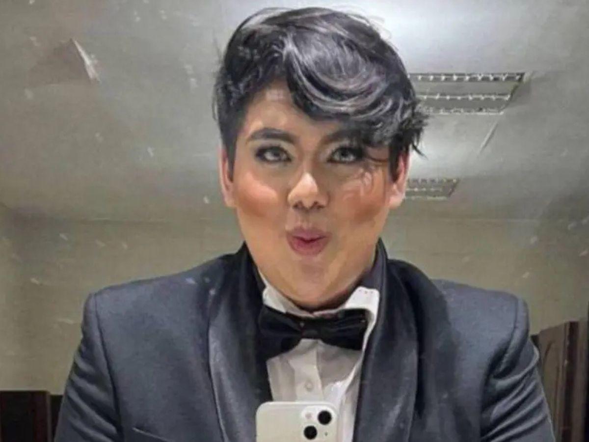 Antonio Sandrez presume sus nuevos labios: “Atáquense y admiren