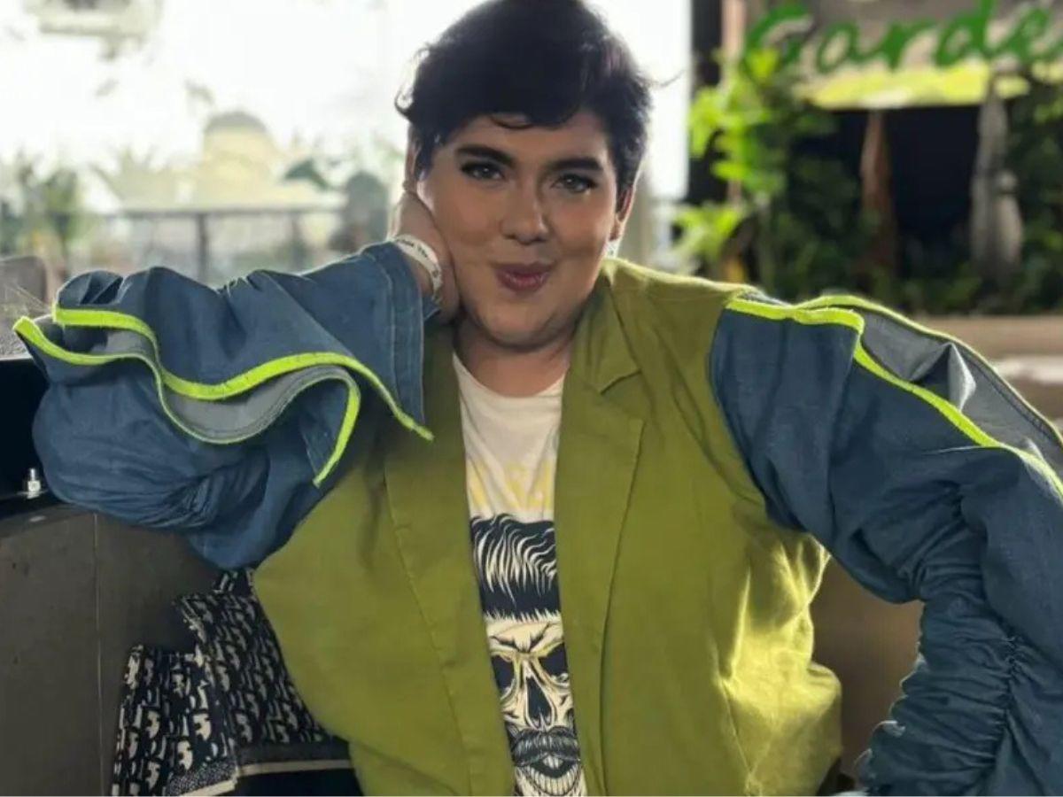 Antonio Sandrez presume sus nuevos labios: “Atáquense y admiren