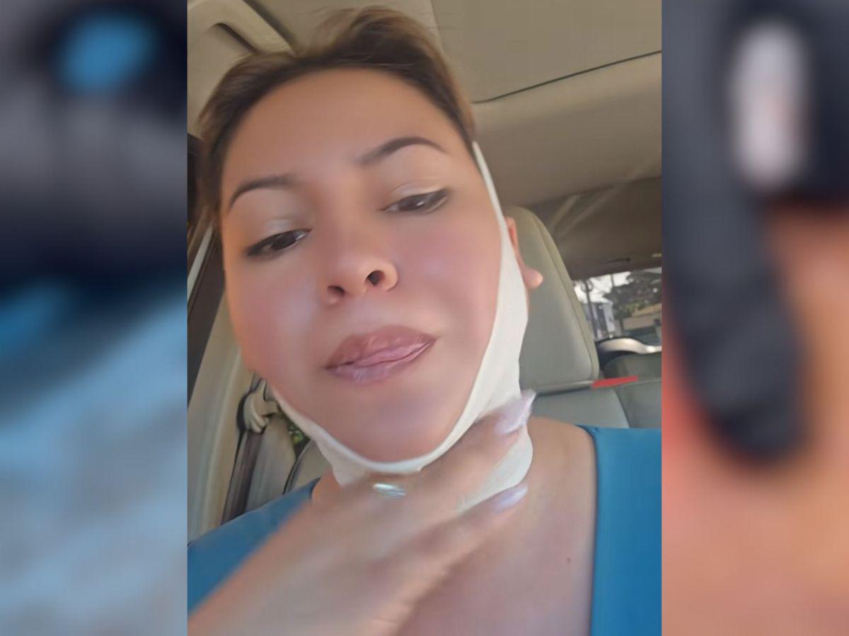 Alejandra Rubio se somete a nuevo procedimiento estético