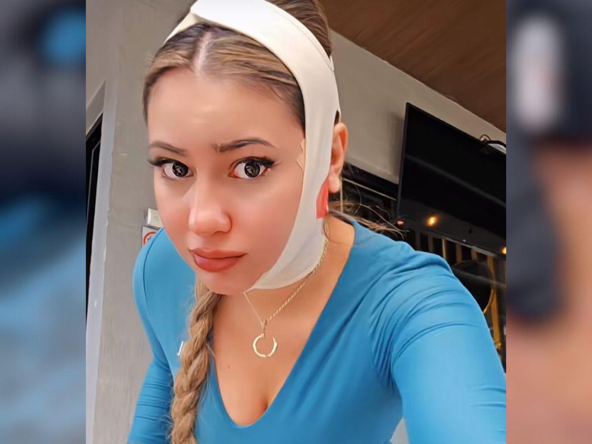 Alejandra Rubio se somete a nuevo procedimiento estético