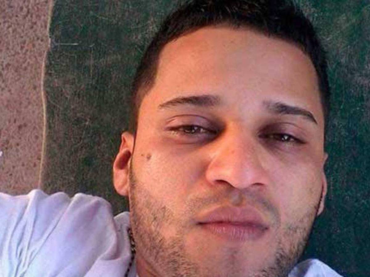 Como si fuera un pitbull: Hombre ataca a mordidas a su pareja en Olancho