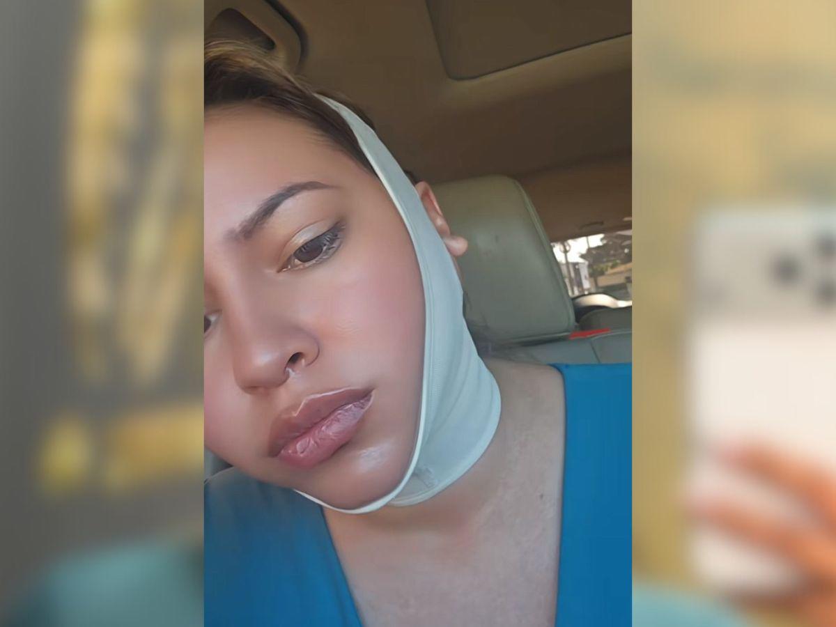 Alejandra Rubio revela el precio de su costosa cirugía