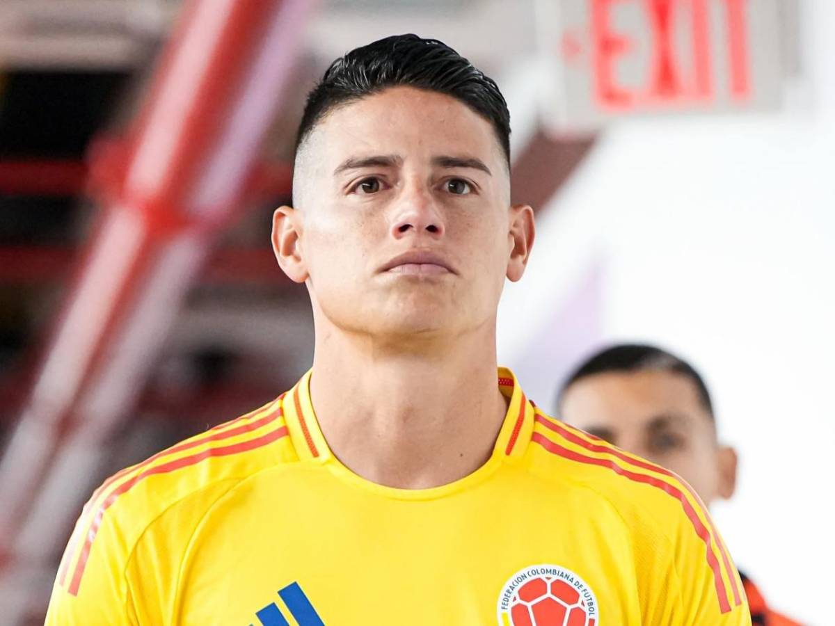 ¿James Rodríguez sufre de rabdomiólisis mortal? Surge noticia sobre el colombiano