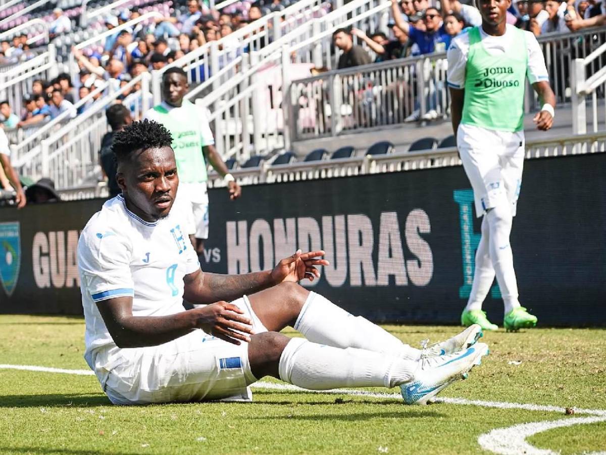 Amargura de Honduras, visita de lujo, sorpresivo debutante y legionarios presentes