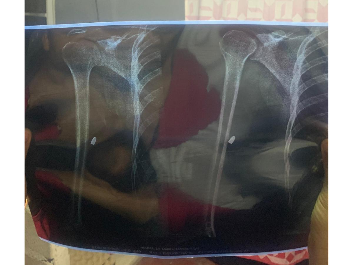 Repartidor baleado por el Burro está vivo de milagro: bala no afectó órganos vitales