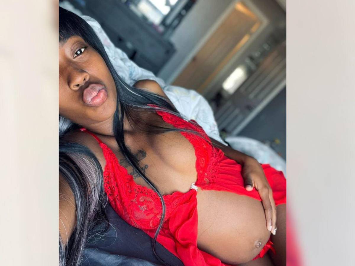 Lidia Arriola es ingresada a UCI para ser operada de emergencia; este es su estado de salud