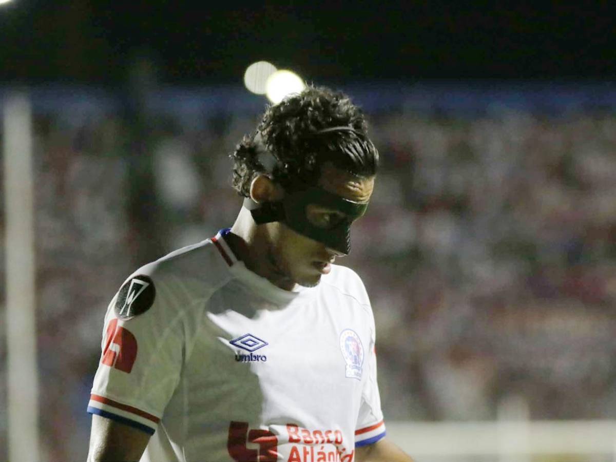 Olimpia da el golpe en Concacaf, dedicatoria, crack de Brasil y periodista roba miradas
