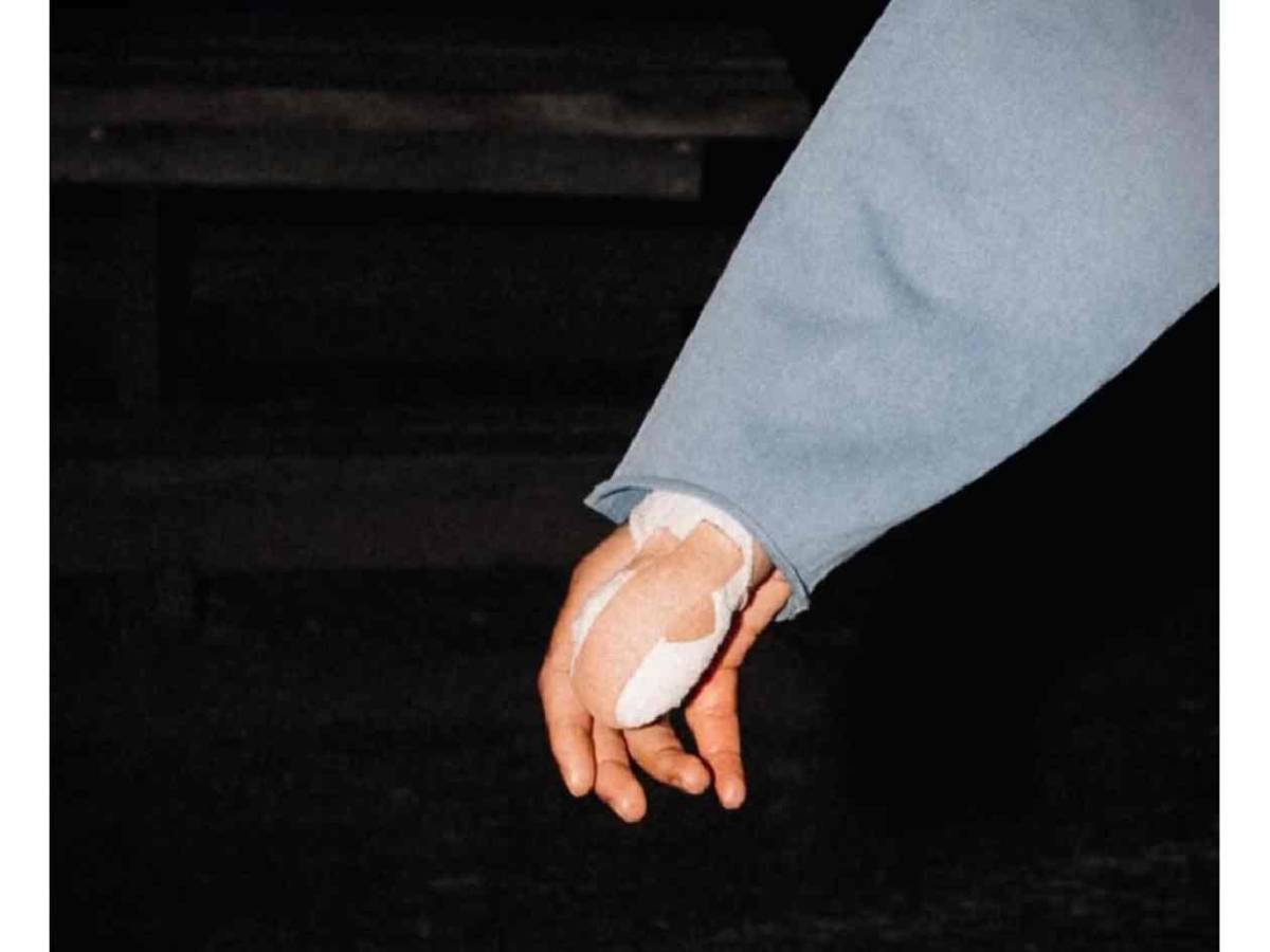 Impactante relato tras insólita lesión en Champions: “Mi pulgar quedó colgando”