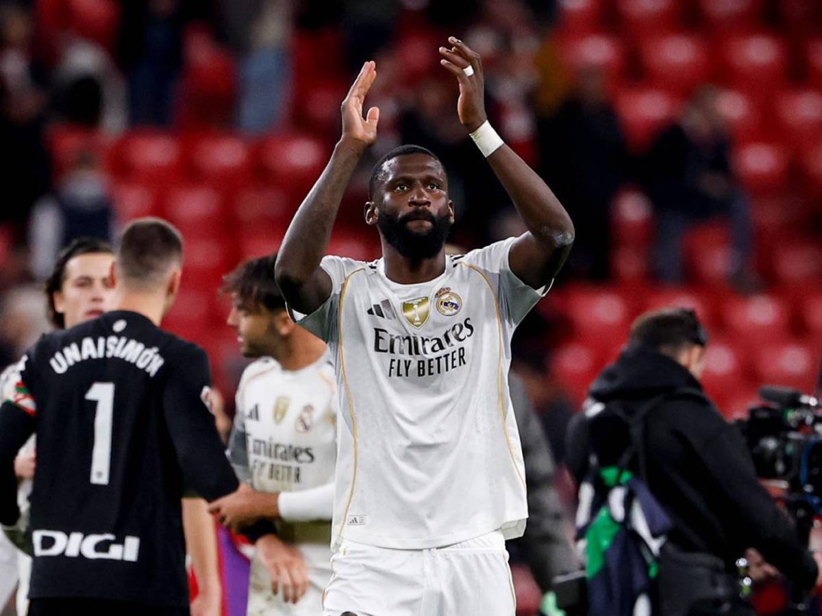 Xabi en problemas: Real Madrid con 9 bajas oficiales vs Alavés... ¿y Mbappé?